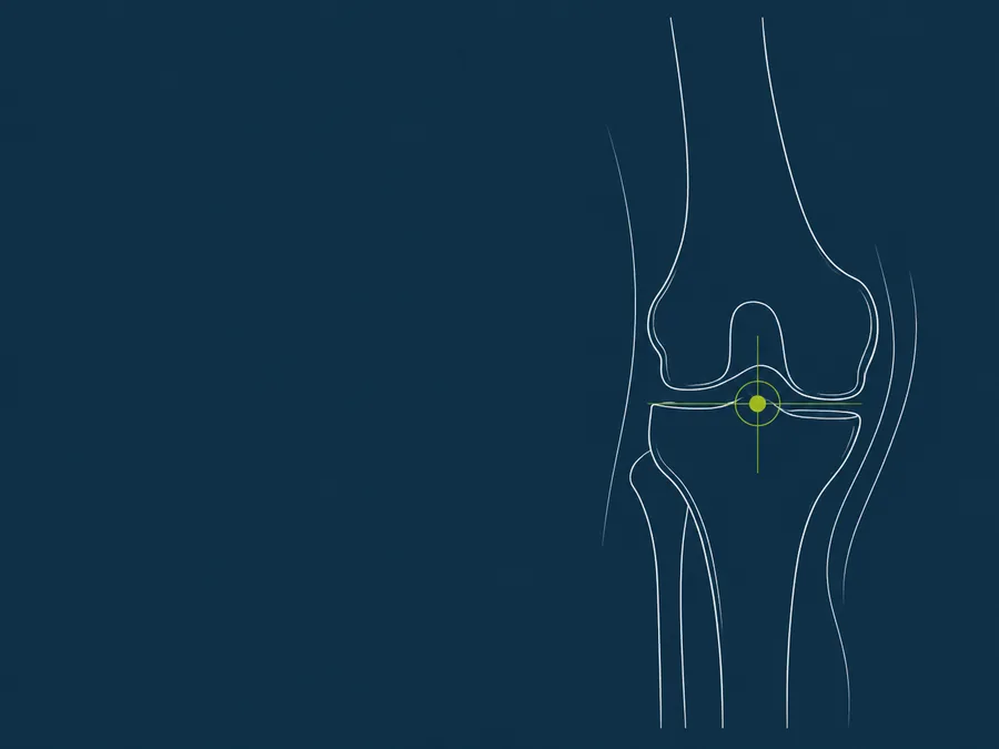 Line illustration of a knee joint