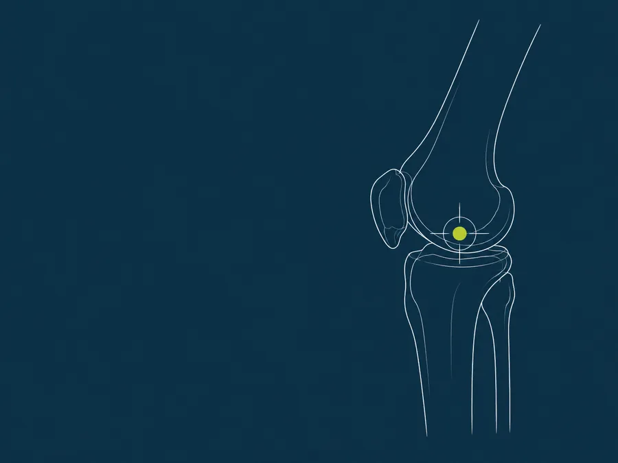 Line illustration of a knee joint with an injection target