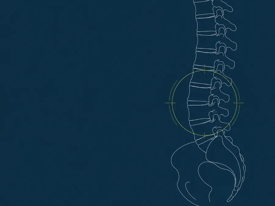 Line illustration of the lumbar spine